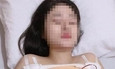Tử vong sau khi nâng ngực