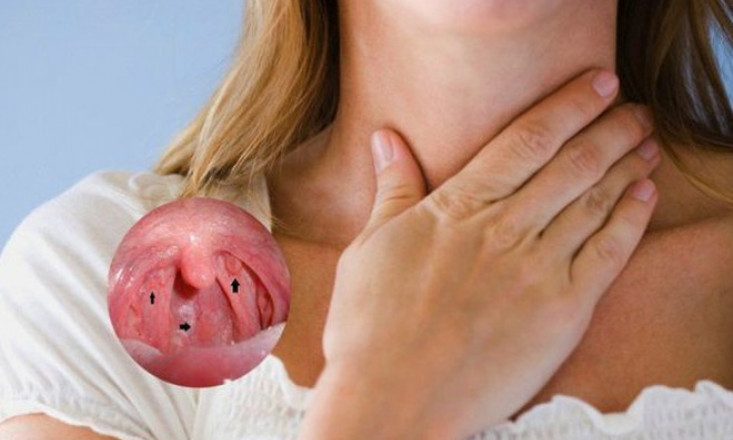 Ung thư vòm họng: Dấu hiệu nhận biết và cách tầm soát