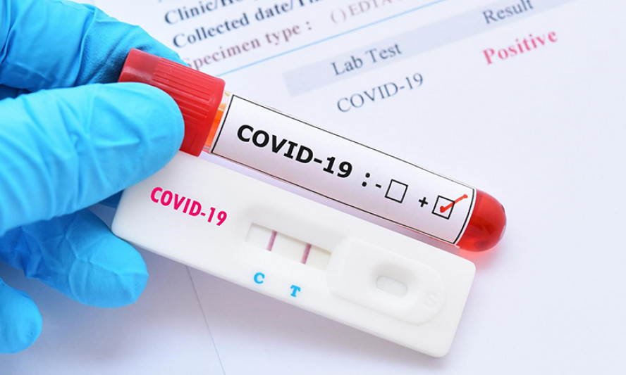 Chuyên gia khuyến cáo- Bệnh nhân ung thư tiết niệu cần làm gì trong dịch COVID-19?