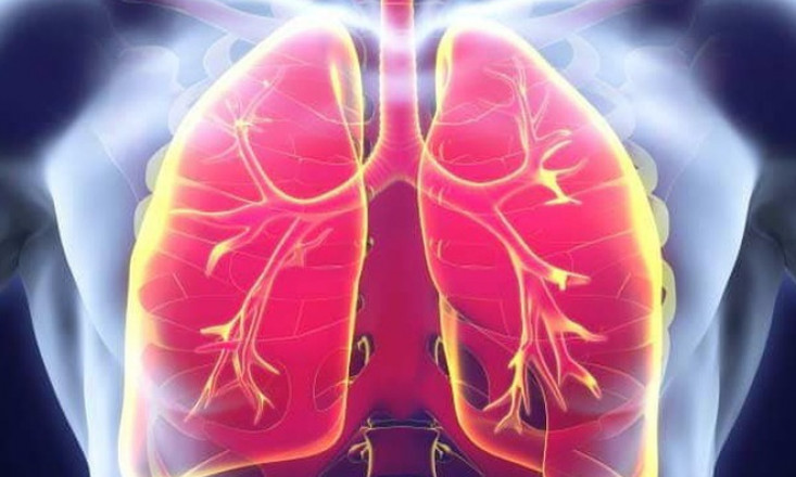 Dấu hiệu cảnh báo sớm của bệnh ung thư phổi