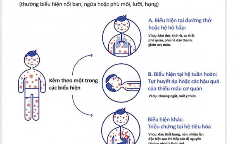 Nhận biết dị ứng, phản vệ khi tiêm vaccine Covid-19