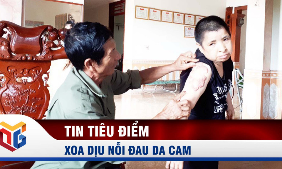 Xoa dịu nỗi đau da cam