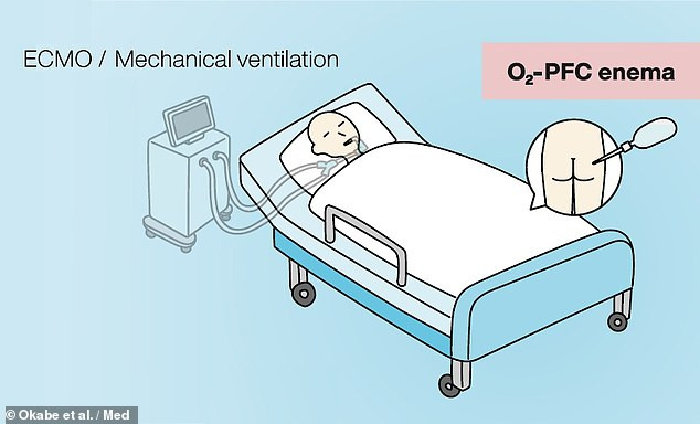 Giải pháp khó tin rút ra từ đại dịch COVID-19: Con người cần khai mở một đường thở mới, qua đằng hậu môn? - Ảnh 6.