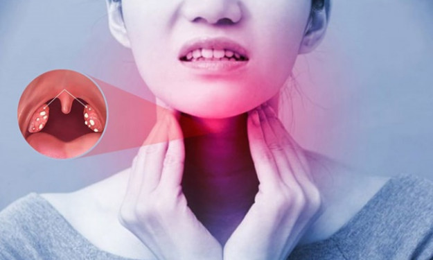 Viêm amidan mãn tính: Nguyên nhân, triệu chứng và cách phòng ngừa