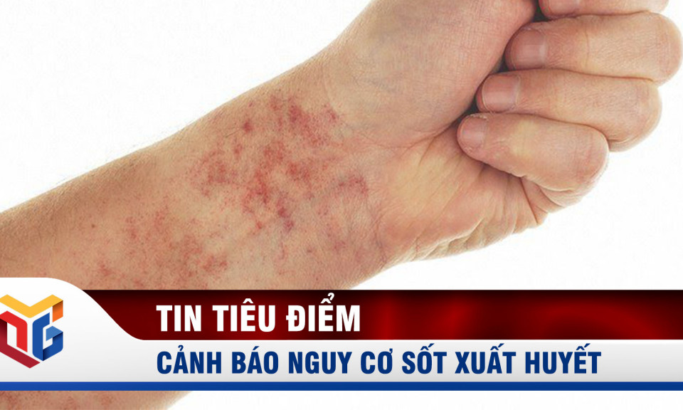 Hạ Long: Cảnh báo nguy cơ sốt xuất huyết