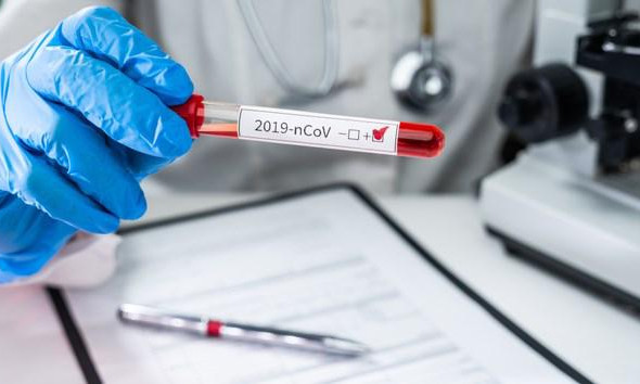 Viêm phổi COVID-19, triệu chứng và những điều cần biết