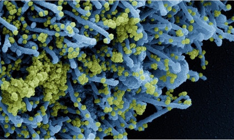 Phát hiện mới về hiệu quả của vaccine với biến chủng Delta