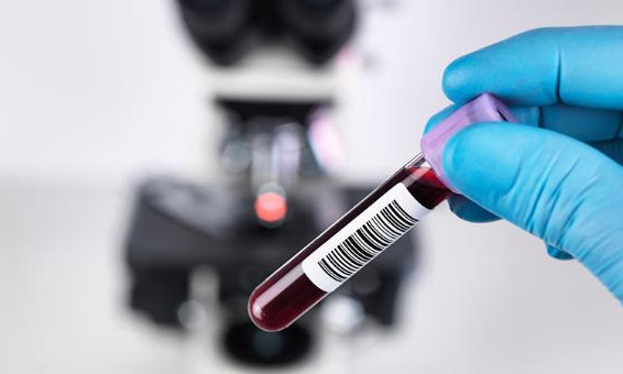 Sau tiêm 2 mũi vaccine COVID-19, có cần làm xét nghiệm kháng thể?