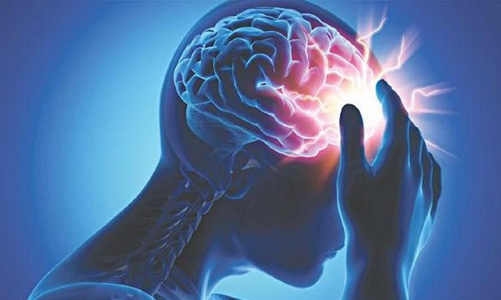 Đột quỵ: Nguyên nhân, dấu hiệu và cách phòng tránh khi trời lạnh đột ngột