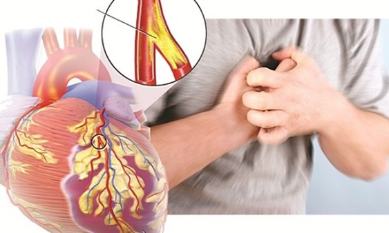 Cảnh báo dấu hiệu bị nhồi máu cơ tim trong mùa lạnh