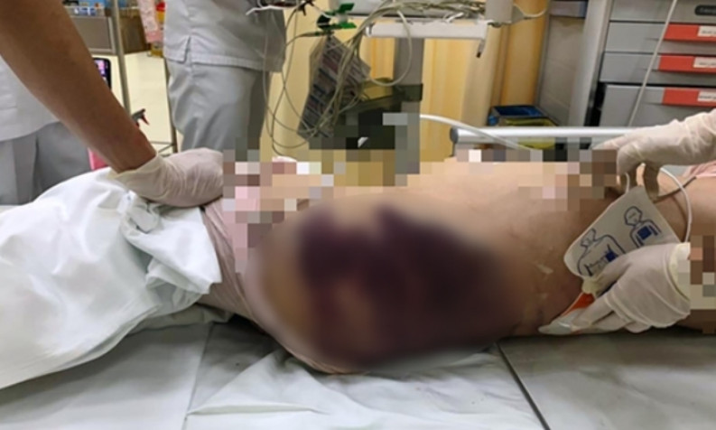 'Dì ghẻ' bị khởi tố tội danh kịch khung 3 năm tù, nhiều luật sư không đồng tình