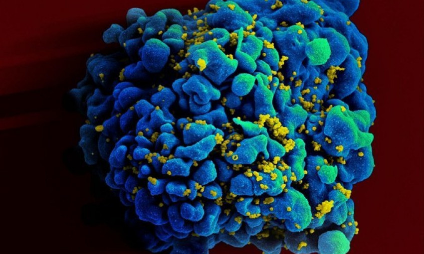 Anh phát hiện chủng HIV lây lan nhanh và nguy hiểm hơn