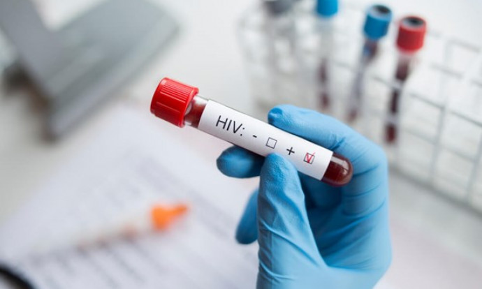 Người phụ nữ đầu tiên khỏi nhiễm HIV sau khi được ghép tế bào gốc