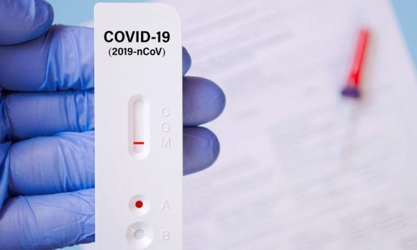 Kiểm tra việc kinh doanh, mua bán test xét nghiệm COVID-19 của cơ sở kinh doanh kit, test xét nghiệm COVID-19