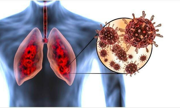 Khó thở dai dẳng là dấu hiệu tổn thương phổi ở bệnh nhân mắc COVID-19