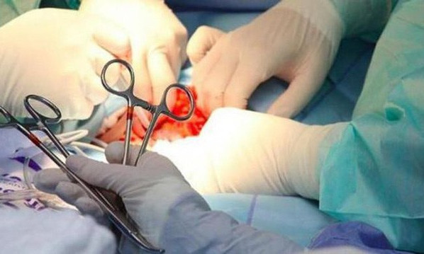 Vợ dùng dao cắt đứt ‘của quý’ của chồng rồi đi tự thú