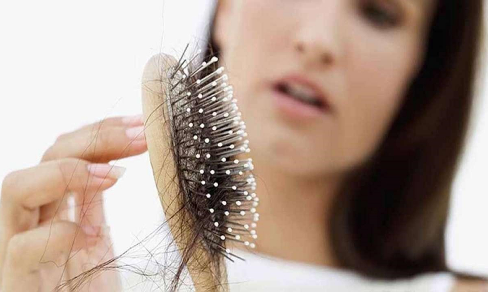 F0 khỏi bệnh rụng tóc đến hói đầu, bác sĩ chỉ cách khắc phục