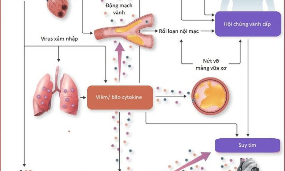 Gặp các triệu chứng về tim mạch hậu COVID-19, người bệnh cần làm gì?