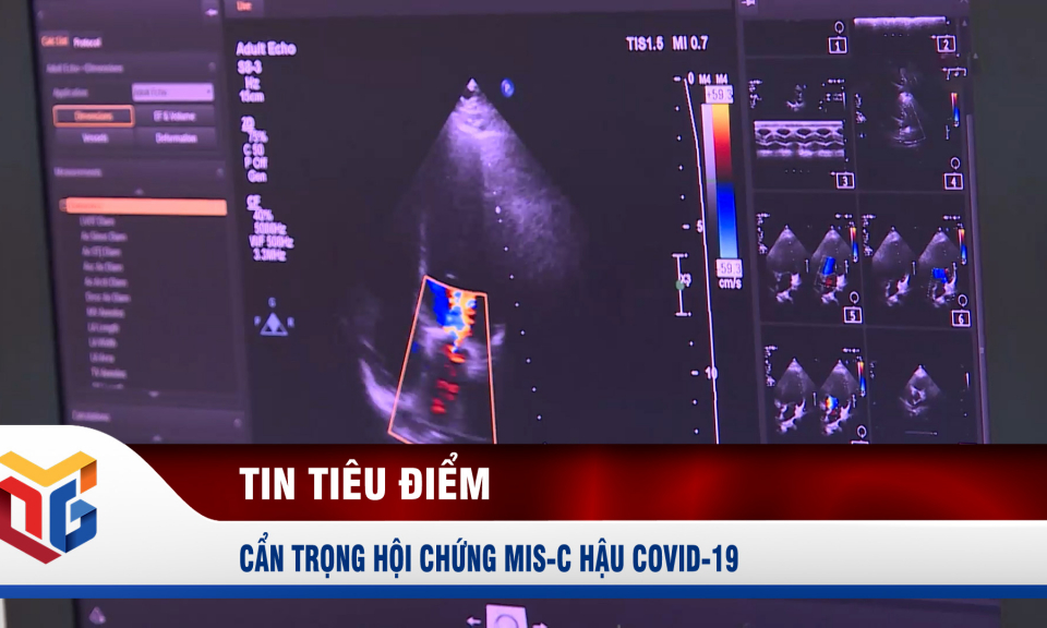 Cẩn trọng Hội chứng MIS-C hậu Covid-19 