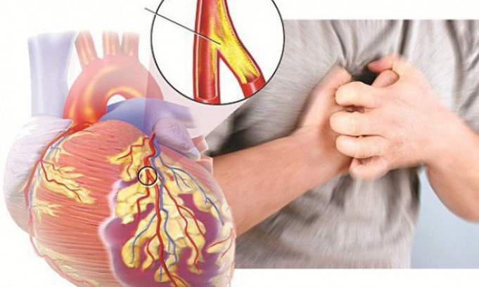 Một số lưu ý khi dùng thuốc điều trị triệu chứng suy tim