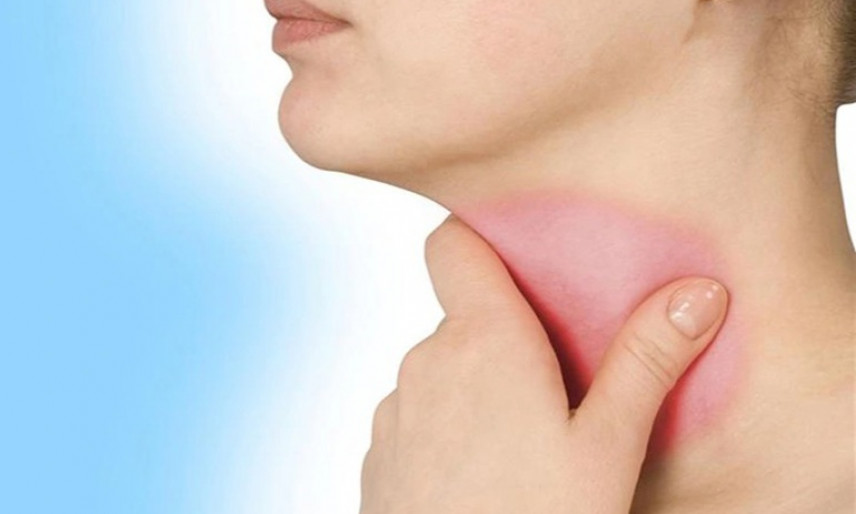 Dấu hiệu viêm họng kéo dài cảnh báo bệnh nguy hiểm