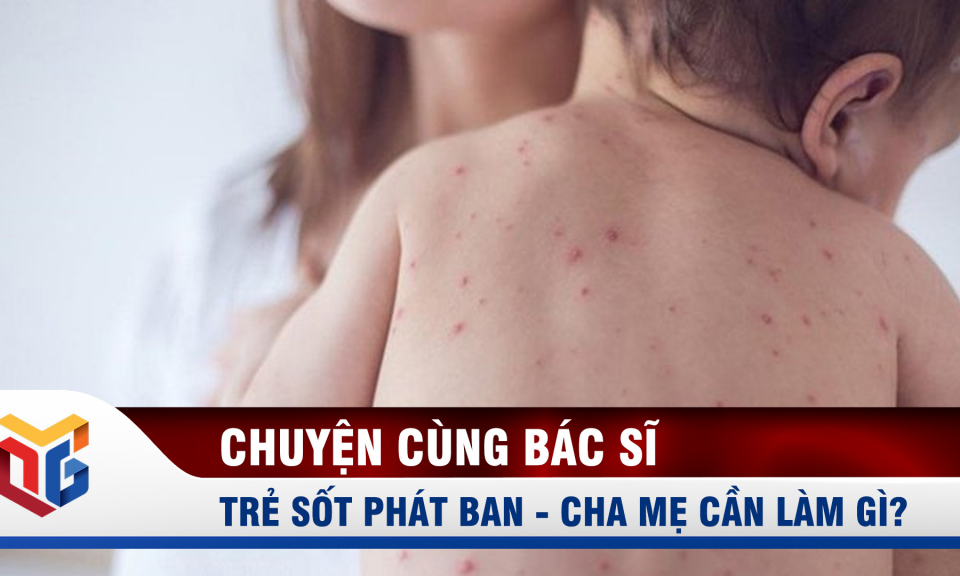 Cha mẹ cần làm gì khi trẻ sốt phát ban