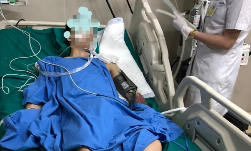 Nguy kịch sau hút thuốc lào