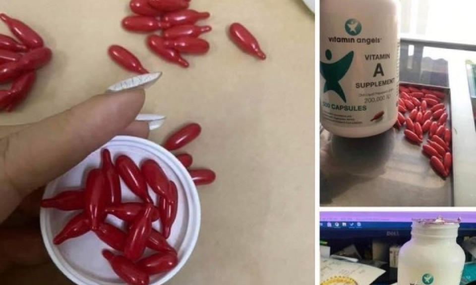 Rao bán vitamin A liều cao 'tuồn từ trạm y tế' cho trẻ uống