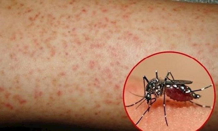 Phòng tránh bệnh sốt xuất huyết