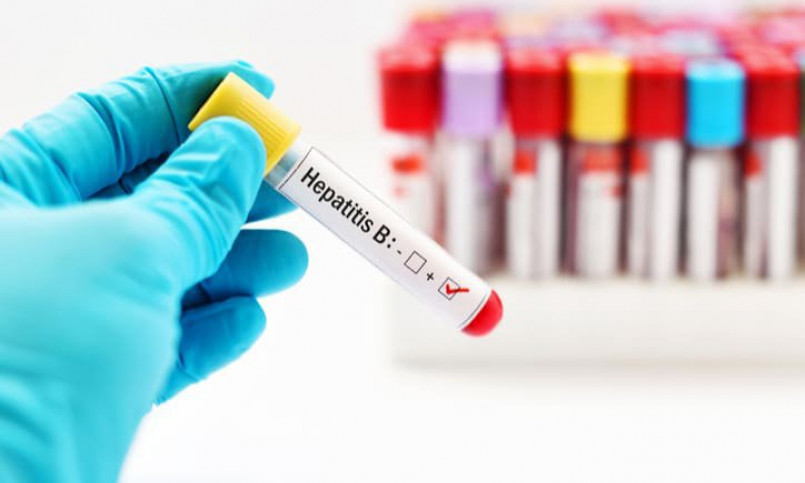 Các thuốc kháng virus trị viêm gan B, những bất lợi cần lưu ý