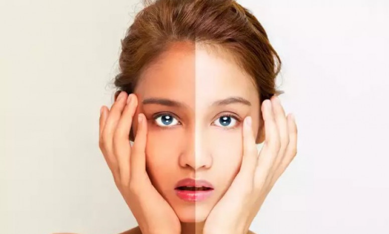 Cách chữa làn da bị cháy nắng hiệu quả nhất tại nhà