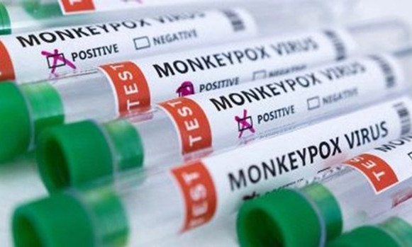 EU cấp phép sử dụng vaccine của Bavarian Nordic phòng đậu mùa khỉ