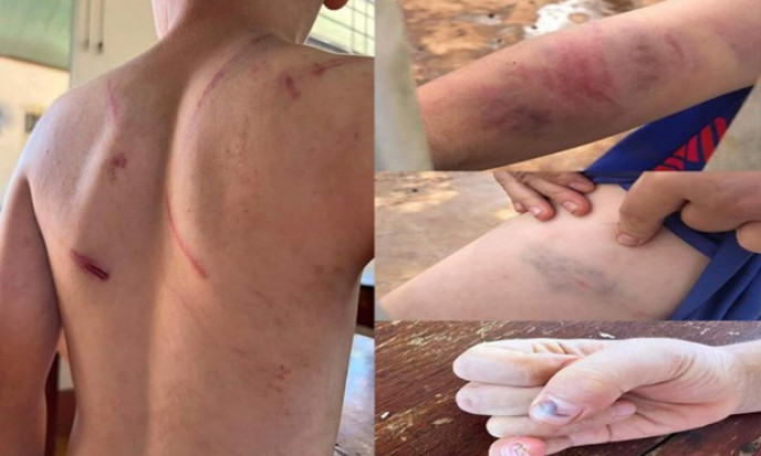 Vụ cháu bé 9 tuổi bị đánh đập ở Đắk Lắk: Khởi tố bà nội và cha ruột