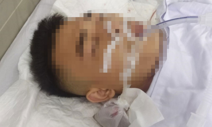 Bắt nhóm côn đồ nổ súng khiến một người trọng thương