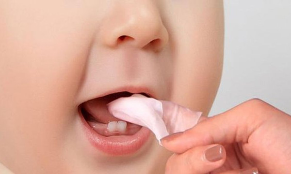 Cách chăm sóc đúng khi trẻ bị nhiệt miệng