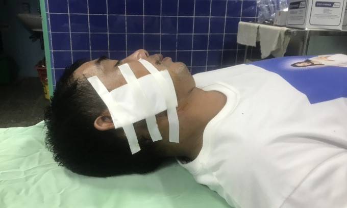 Người đàn ông bị gấu rừng tấn công