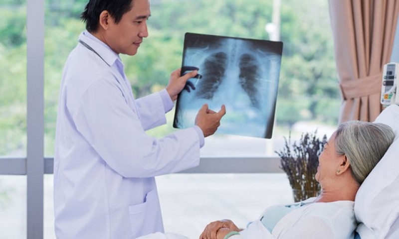 Viêm phổi mắc phải cộng đồng: Dấu hiệu nhận biết và cách phòng ngừa