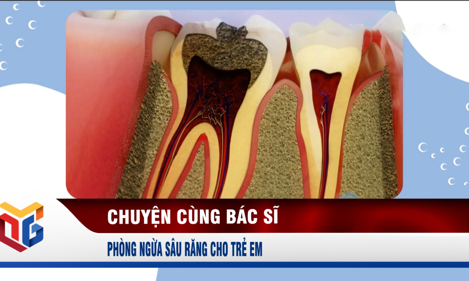 Phòng ngừa sâu răng cho trẻ em