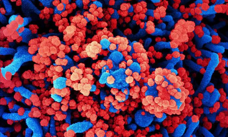 Mỹ phát triển phương pháp xác định các đột biến của virus SARS-CoV-2