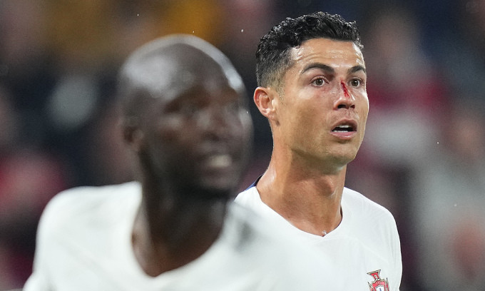 Ronaldo đổ máu trong trận thắng đậm của Bồ Đào Nha