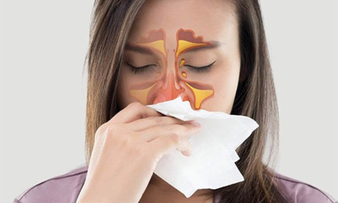 Mùa mưa bị viêm mũi, viêm xoang tái phát cần phải làm gì?