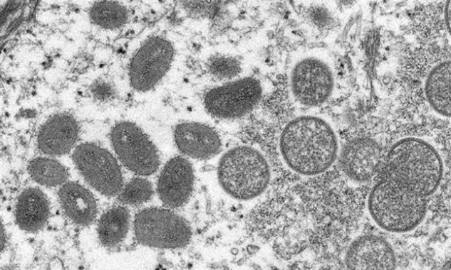TP.HCM: Bệnh nhân đầu tiên mắc đậu mùa khỉ đã âm tính với virus