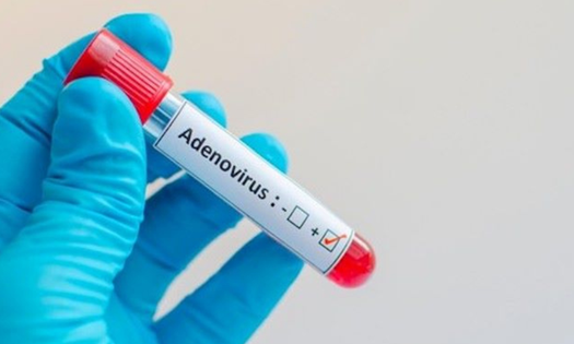 Khi nào nên xét nghiệm Adenovirus cho trẻ?