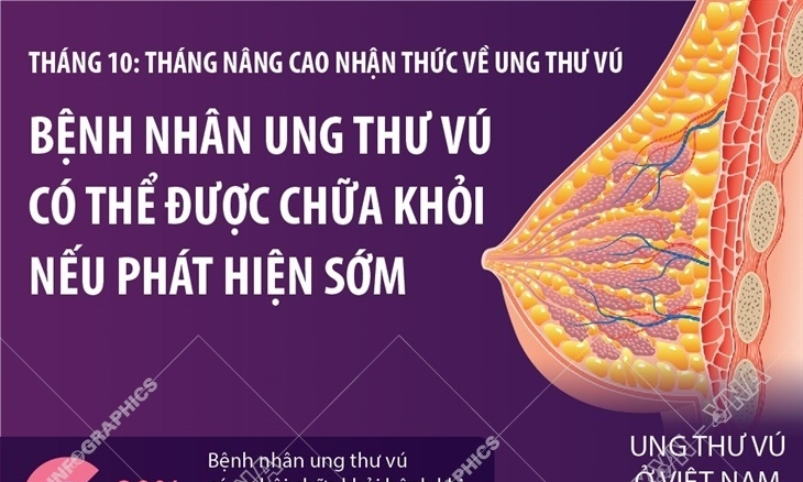 Bệnh nhân ung thư vú có thể được chữa khỏi nếu phát hiện sớm