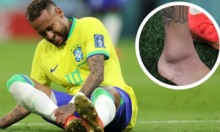 Neymar tiến triển thần tốc