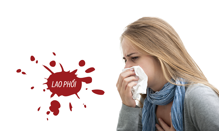 WHO cập nhật hướng dẫn mới về điều trị bệnh lao kháng thuốc