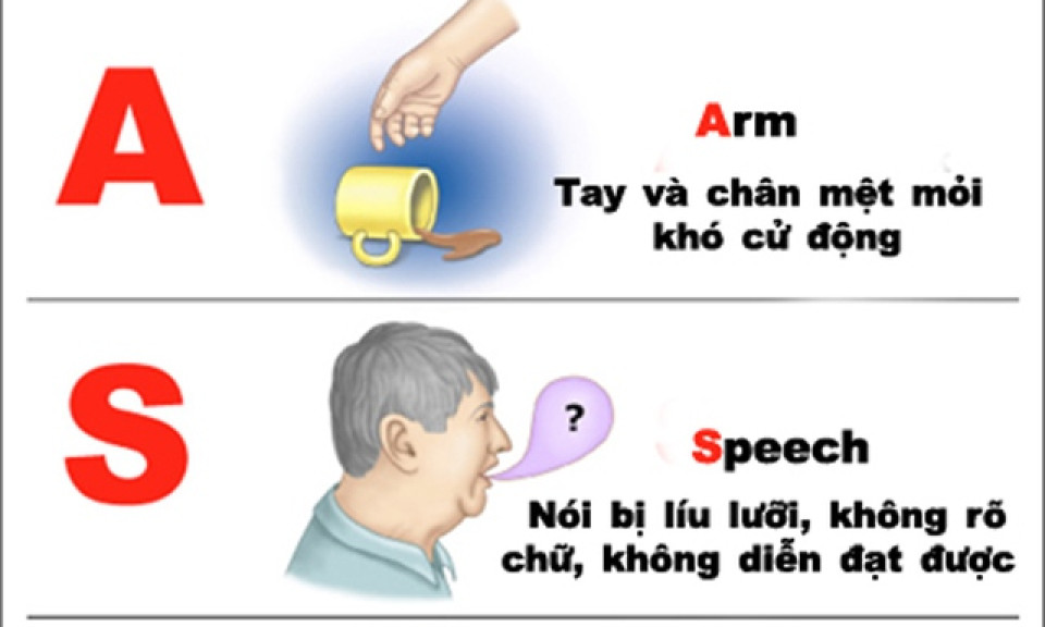 Nhiệt độ giảm sâu, bác sĩ chỉ cách phòng ngừa đột quỵ