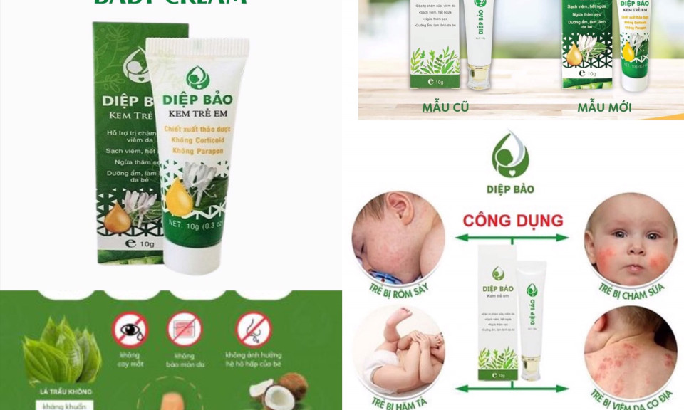 Cục Dược thông tin về kem bôi da trẻ em sản xuất tại Việt Nam bị Mỹ thu hồi