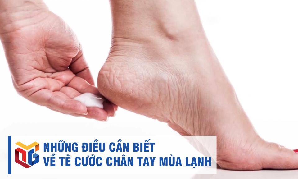 Những điều cần biết về tê cước chân tay mùa lạnh