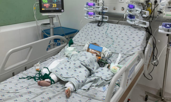 Bà vừa bế cháu vừa nướng mực khiến trẻ 6 tháng tuổi gặp nạn